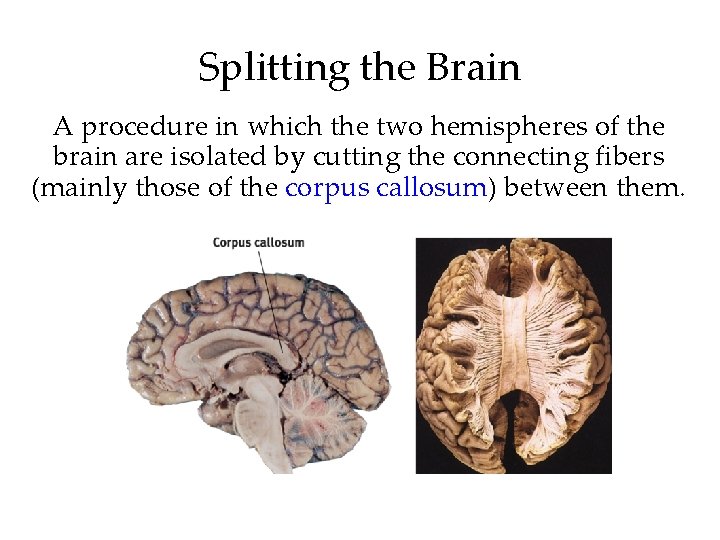 Splitting the Brain A procedure in which the two hemispheres of the brain are