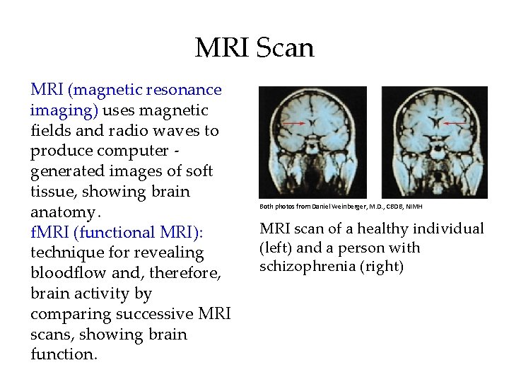 MRI Scan MRI (magnetic resonance imaging) uses magnetic fields and radio waves to produce