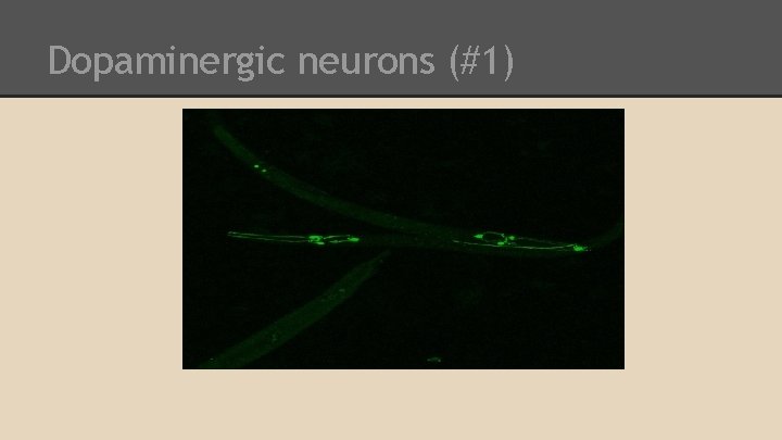 Dopaminergic neurons (#1) 