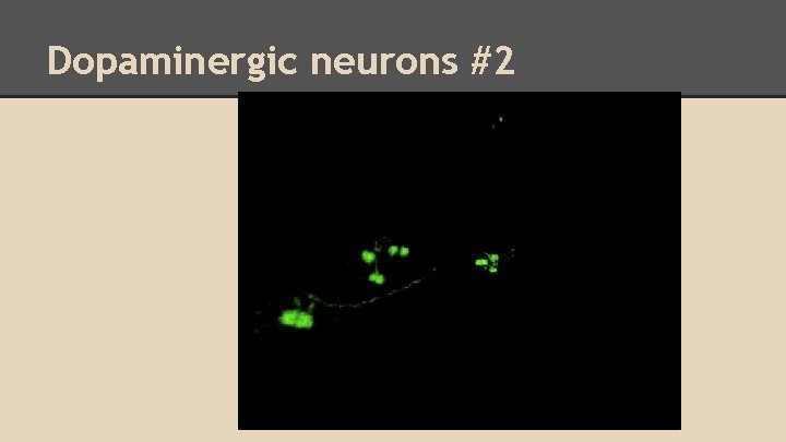 Dopaminergic neurons #2 