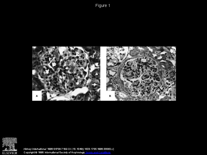 Figure 1 Kidney International 1998 54706 -719 DOI: (10. 1046/j. 1523 -1755. 1998. 00062.
