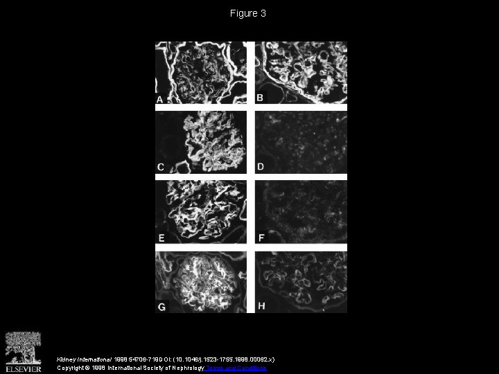 Figure 3 Kidney International 1998 54706 -719 DOI: (10. 1046/j. 1523 -1755. 1998. 00062.