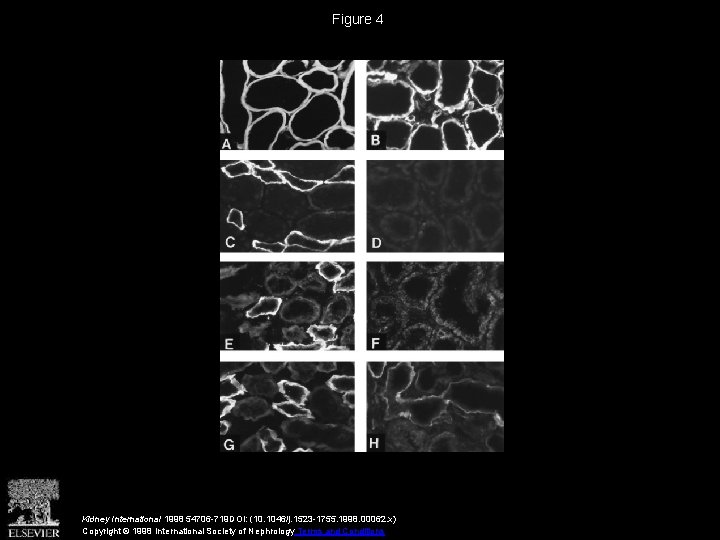 Figure 4 Kidney International 1998 54706 -719 DOI: (10. 1046/j. 1523 -1755. 1998. 00062.
