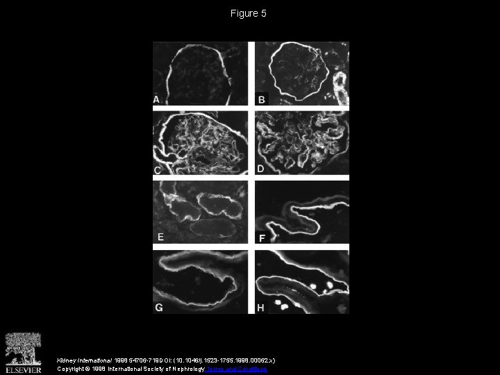 Figure 5 Kidney International 1998 54706 -719 DOI: (10. 1046/j. 1523 -1755. 1998. 00062.