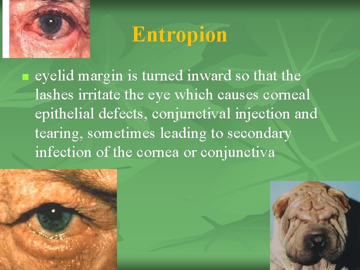 Entropion n eyelid margin is turned inward so that the lashes irritate the eye