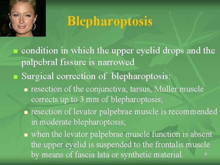 Blepharoptosis n n condition in which the upper eyelid drops and the palpebral fissure