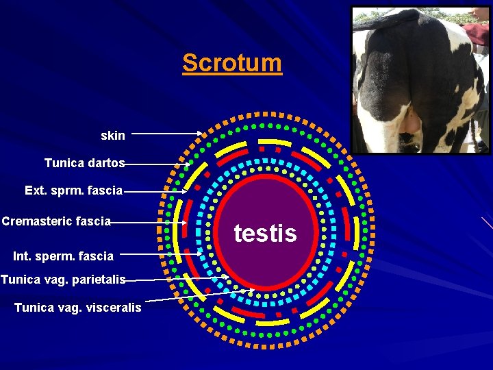 Scrotum skin Tunica dartos Ext. sprm. fascia Cremasteric fascia Int. sperm. fascia Tunica vag.