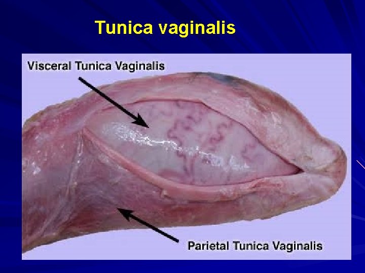 Tunica vaginalis 
