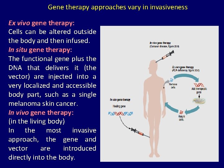 Gene therapy approaches vary in invasiveness Ex vivo gene therapy: Cells can be altered