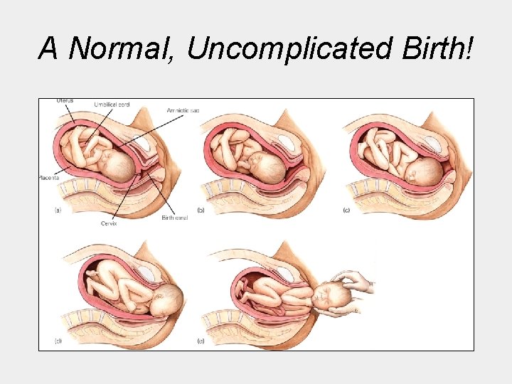 A Normal, Uncomplicated Birth! 