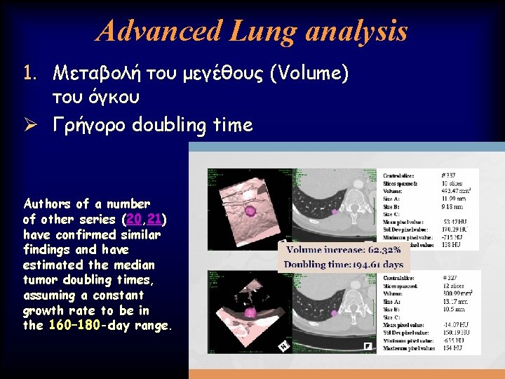 Advanced Lung analysis 1. Μεταβολή του μεγέθους (Volume) του όγκου Ø Γρήγορο doubling time