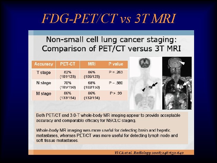 FDG-PET/CT vs 3 T MRI 
