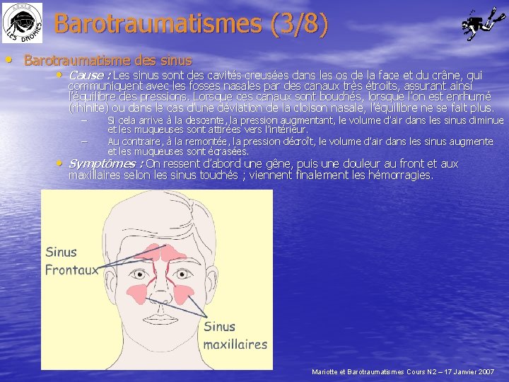Barotraumatismes (3/8) • Barotraumatisme des sinus • Cause : Les sinus sont des cavités