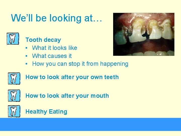 We’ll be looking at… Tooth decay • What it looks like • What causes