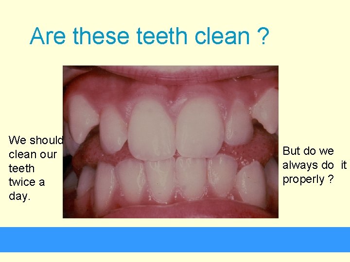 Are these teeth clean ? We should clean our teeth twice a day. But