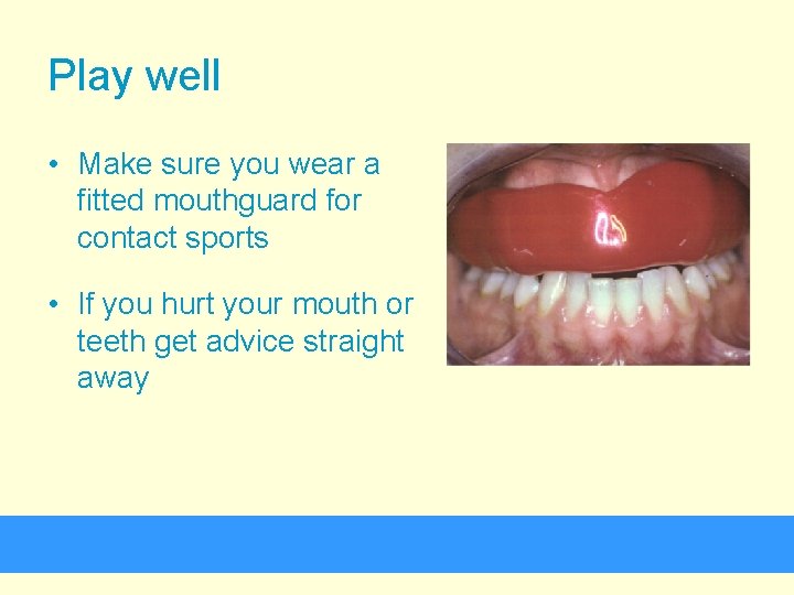 Play well • Make sure you wear a fitted mouthguard for contact sports •