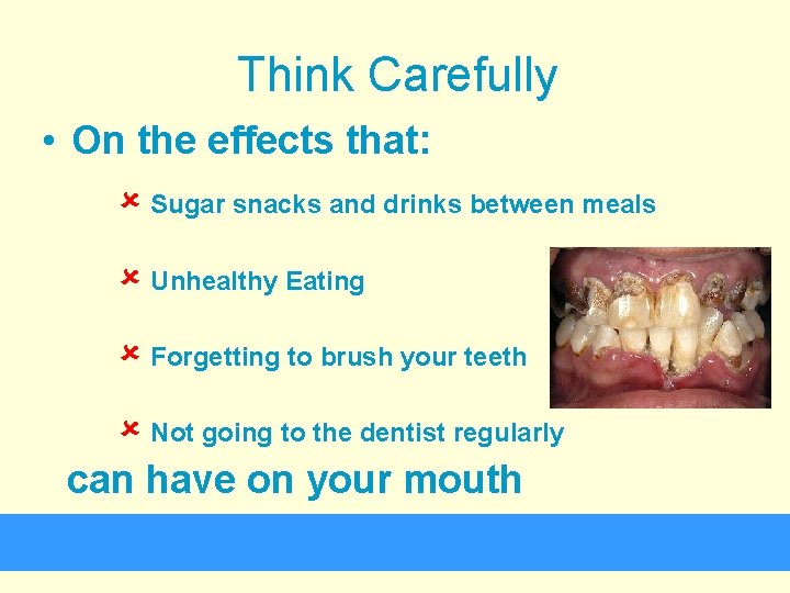 Think Carefully • On the effects that: û Sugar snacks and drinks between meals