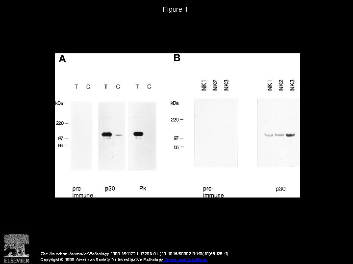 Figure 1 The American Journal of Pathology 1999 1541721 -1729 DOI: (10. 1016/S 0002