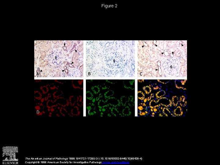 Figure 2 The American Journal of Pathology 1999 1541721 -1729 DOI: (10. 1016/S 0002