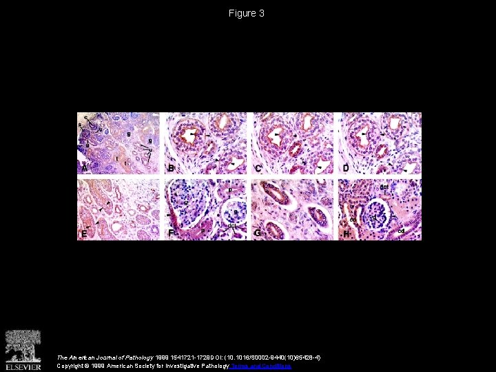 Figure 3 The American Journal of Pathology 1999 1541721 -1729 DOI: (10. 1016/S 0002