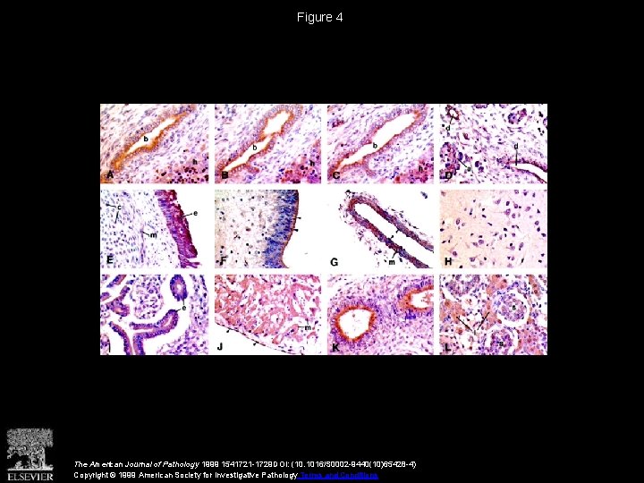 Figure 4 The American Journal of Pathology 1999 1541721 -1729 DOI: (10. 1016/S 0002