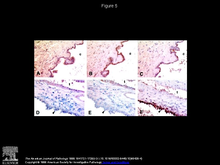 Figure 5 The American Journal of Pathology 1999 1541721 -1729 DOI: (10. 1016/S 0002