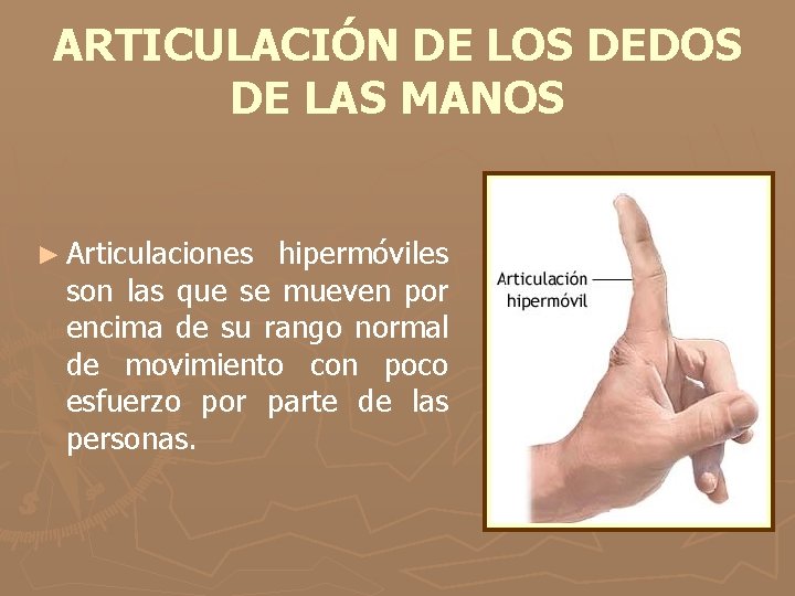 ARTICULACIÓN DE LOS DEDOS DE LAS MANOS ► Articulaciones hipermóviles son las que se