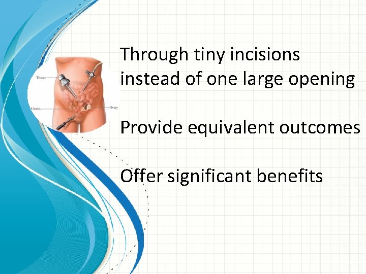 Through tiny incisions instead of one large opening Provide equivalent outcomes Offer significant benefits