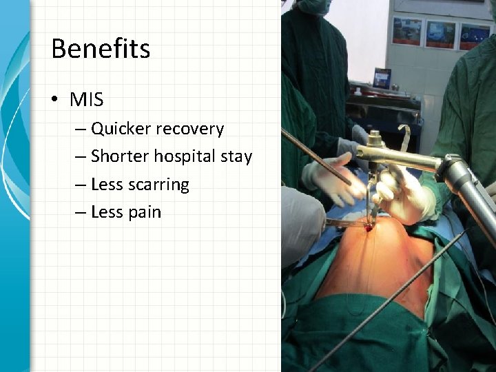 Benefits • MIS – Quicker recovery – Shorter hospital stay – Less scarring –