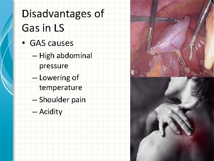 Disadvantages of Gas in LS • GAS causes – High abdominal pressure – Lowering