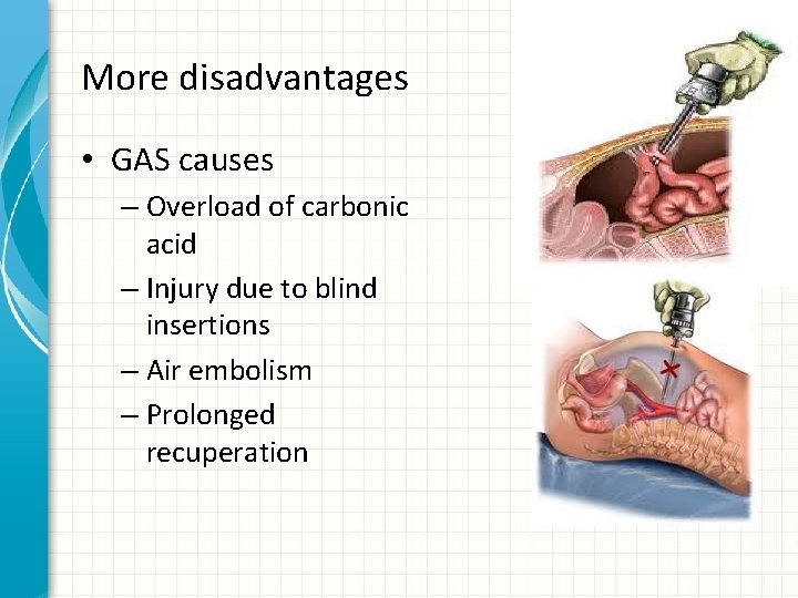 More disadvantages • GAS causes – Overload of carbonic acid – Injury due to