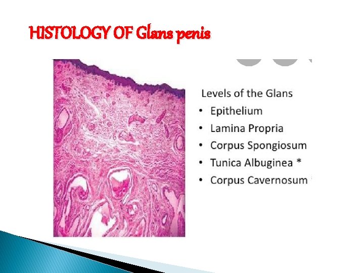 HISTOLOGY OF Glans penis 
