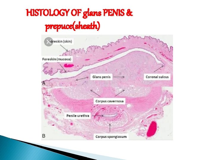 HISTOLOGY OF glans PENIS & prepuce(sheath) 