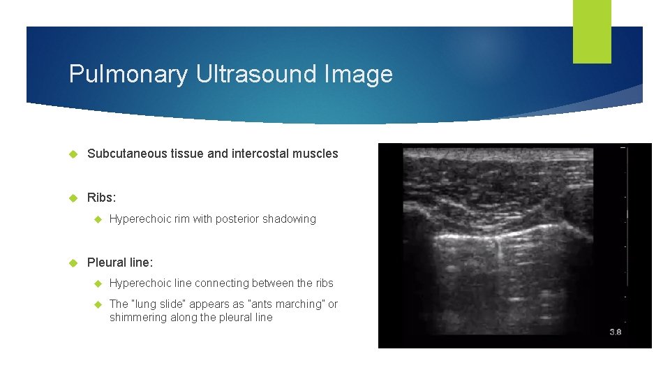 Pulmonary Ultrasound Image Subcutaneous tissue and intercostal muscles Ribs: Hyperechoic rim with posterior shadowing