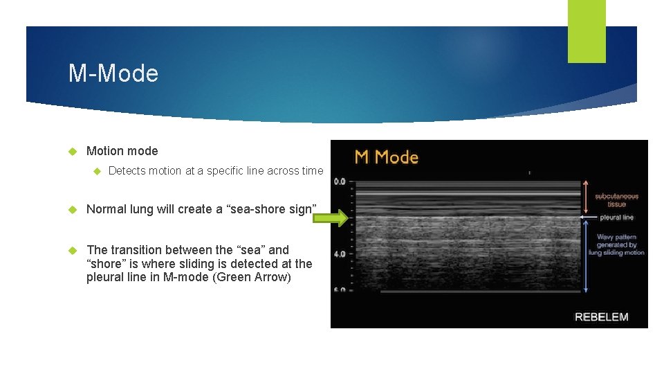 M-Mode Motion mode Detects motion at a specific line across time Normal lung will