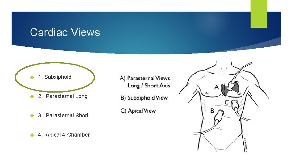 Cardiac Views 1. Subxiphoid 2. Parasternal Long 3. Parasternal Short 4. Apical 4 -Chamber