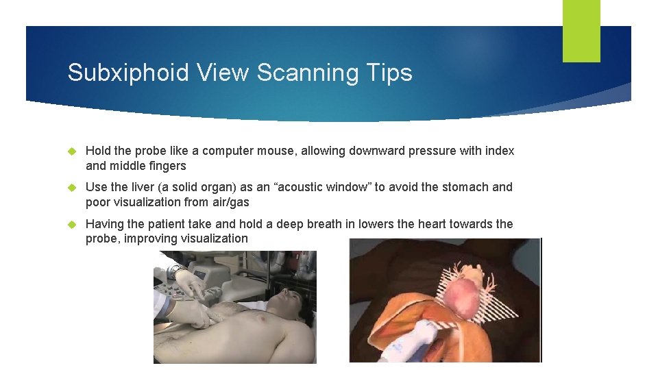 Subxiphoid View Scanning Tips Hold the probe like a computer mouse, allowing downward pressure