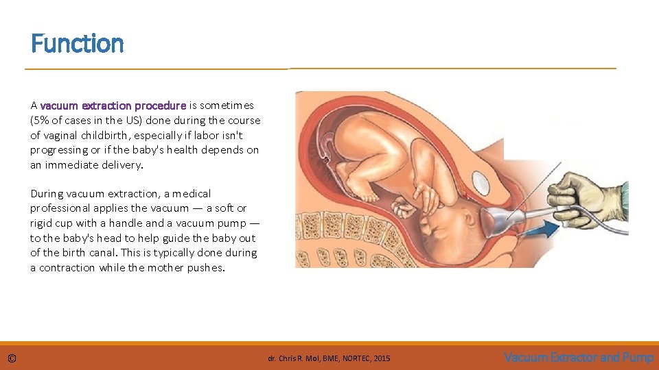 Function A vacuum extraction procedure is sometimes (5% of cases in the US) done