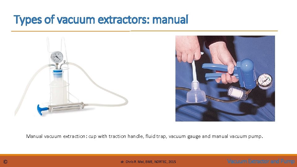 Types of vacuum extractors: manual Manual vacuum extraction: cup with traction handle, fluid trap,