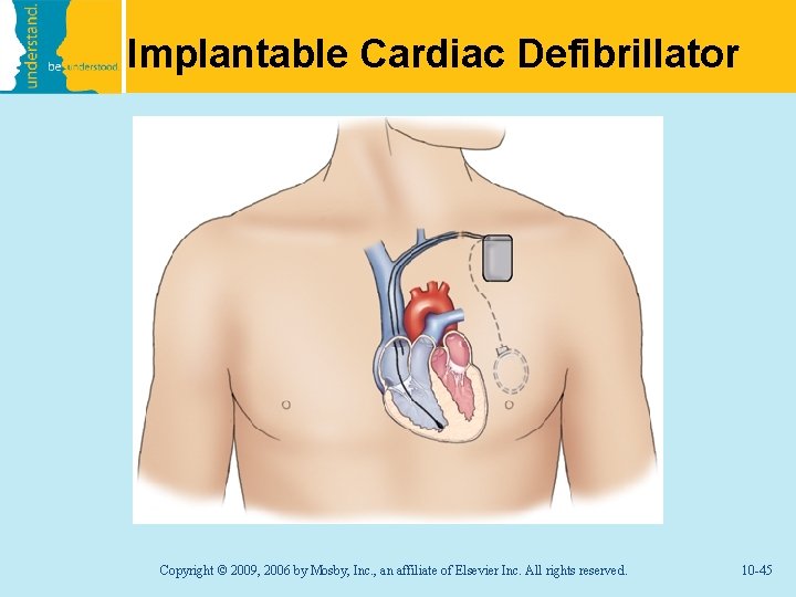 Implantable Cardiac Defibrillator Copyright © 2009, 2006 by Mosby, Inc. , an affiliate of