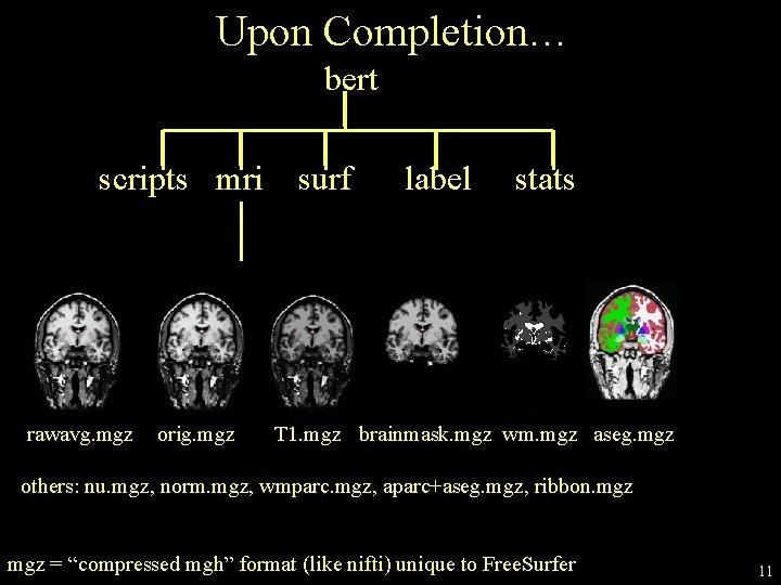 Upon Completion… bert scripts mri rawavg. mgz orig. mgz surf label stats T 1.