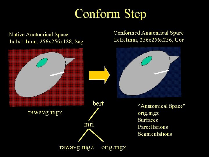 Conform Step Conformed Anatomical Space 1 x 1 x 1 mm, 256 x 256,