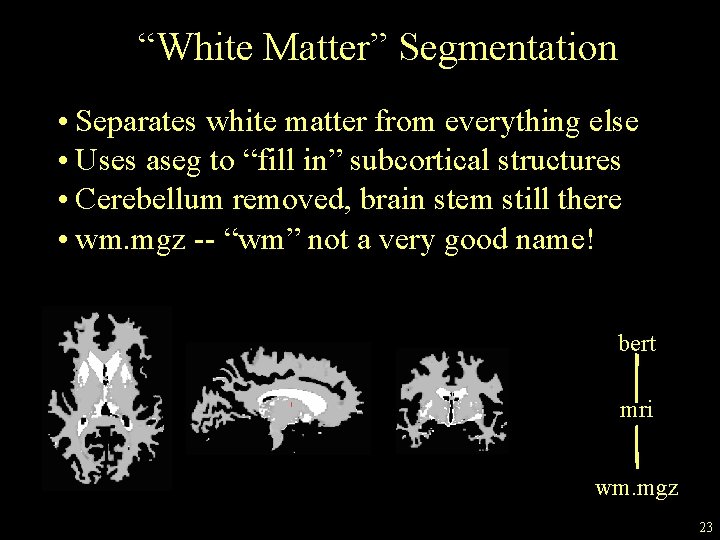 “White Matter” Segmentation • Separates white matter from everything else • Uses aseg to