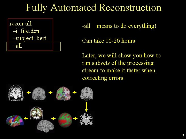 Fully Automated Reconstruction recon-all –i file. dcm –subject bert –all -all means to do