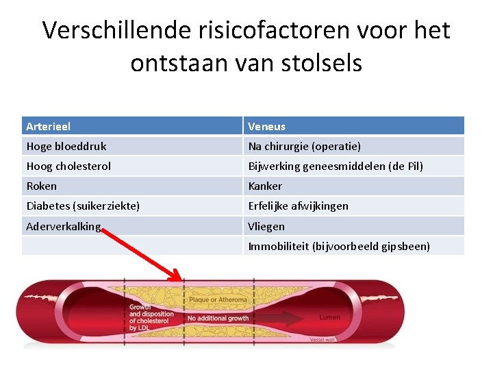 Verschillende risicofactoren voor het ontstaan van stolsels Arterieel Veneus Hoge bloeddruk Na chirurgie (operatie)