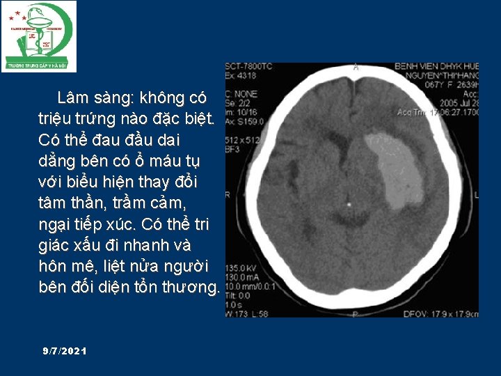 Lâm sàng: không có triệu trứng nào đặc biệt. Có thể đau đầu dai