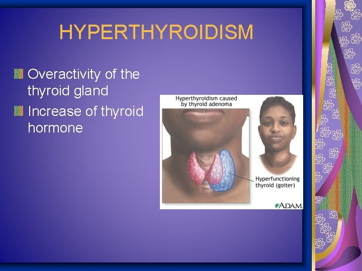 HYPERTHYROIDISM Overactivity of the thyroid gland Increase of thyroid hormone 