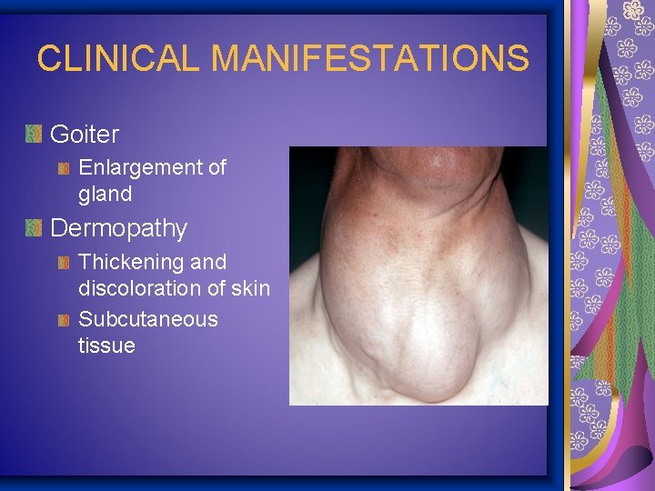 CLINICAL MANIFESTATIONS Goiter Enlargement of gland Dermopathy Thickening and discoloration of skin Subcutaneous tissue