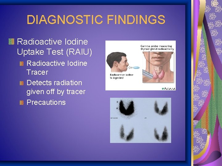 DIAGNOSTIC FINDINGS Radioactive Iodine Uptake Test (RAIU) Radioactive Iodine Tracer Detects radiation given off