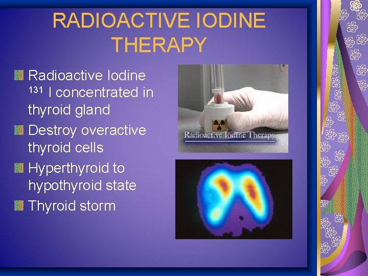RADIOACTIVE IODINE THERAPY Radioactive Iodine 131 I concentrated in thyroid gland Destroy overactive thyroid